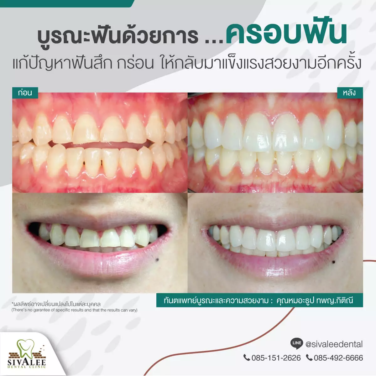 \u0e04\u0e23\u0e2d\u0e1a\u0e1f\u0e31\u0e19 \u0e21\u0e35\u0e01\u0e35\u0e48\u0e41\u0e1a\u0e1a \u0e2d\u0e22\u0e39\u0e48\u0e44\u0e14\u0e49\u0e19\u0e32\u0e19\u0e44\u0e2b\u0e21 \u0e17\u0e33\u0e17\u0e35\u0e48\u0e44\u0e2b\u0e19\u0e14\u0e35 \u0e15\u0e2d\u0e1a\u0e42\u0e14\u0e22\u0e41\u0e1e\u0e17\u0e22\u0e4c\u0e1c\u0e39\u0e49\u0e40\u0e0a\u0e35\u0e48\u0e22\u0e27\u0e0a\u0e32\u0e0d